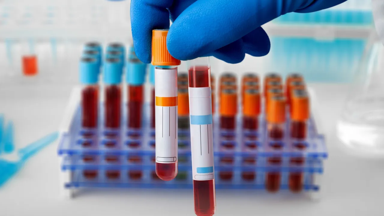 Cancro do estômago: Tipo de sangue pode ser fator de risco