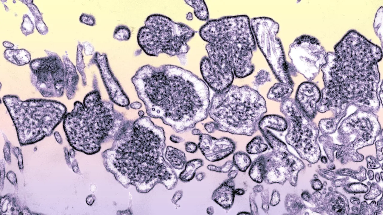 Descoberto nanocorpo capaz de neutralizar os vírus mortais Hendra e Nipah