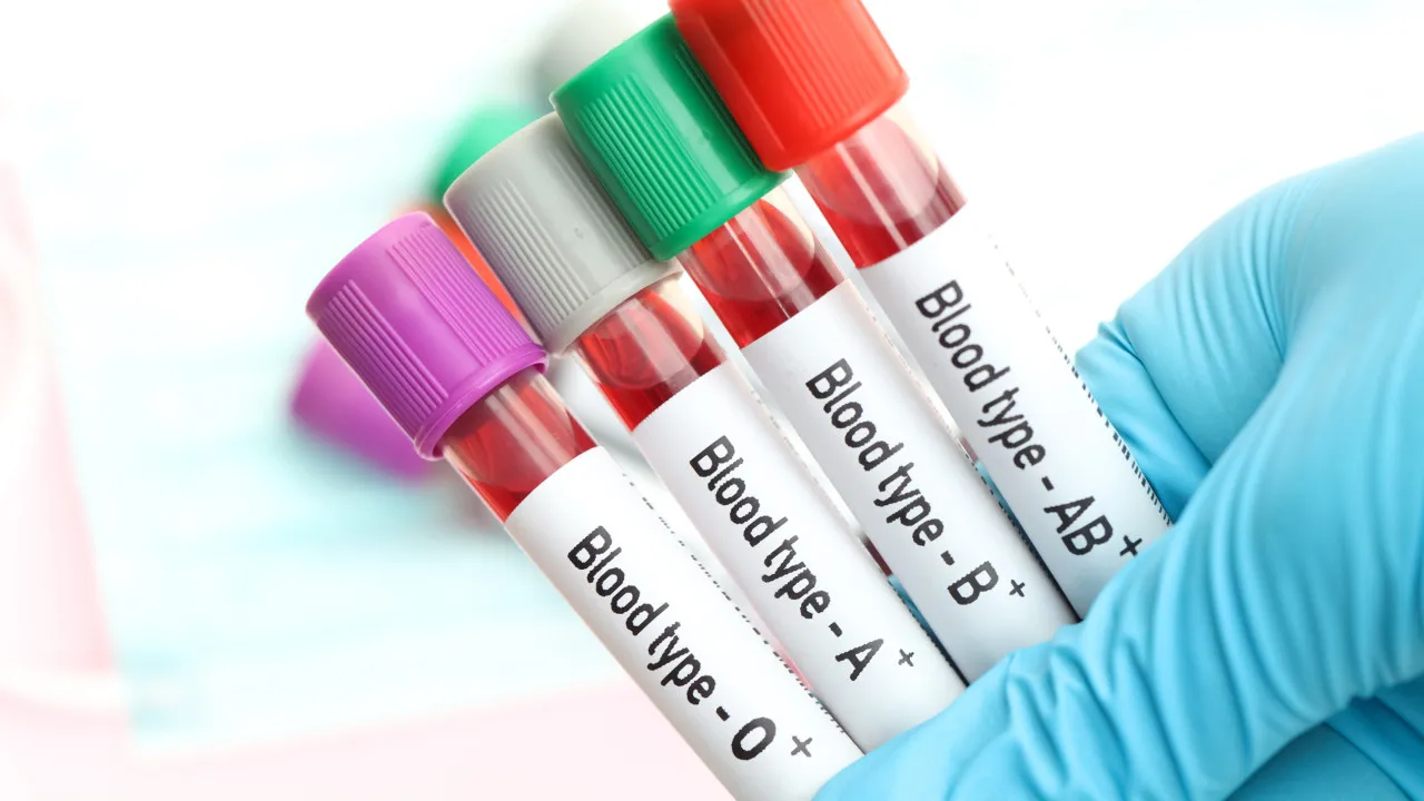 Tipo de sangue e risco de AVC: Estudo revela ligação surpreendente